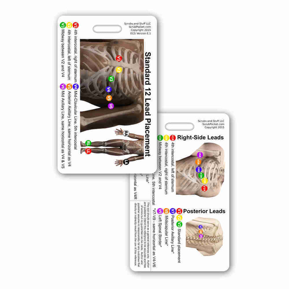 Code 1 Supply 12-Lead EKG Placement Badge Card - VERTICAL